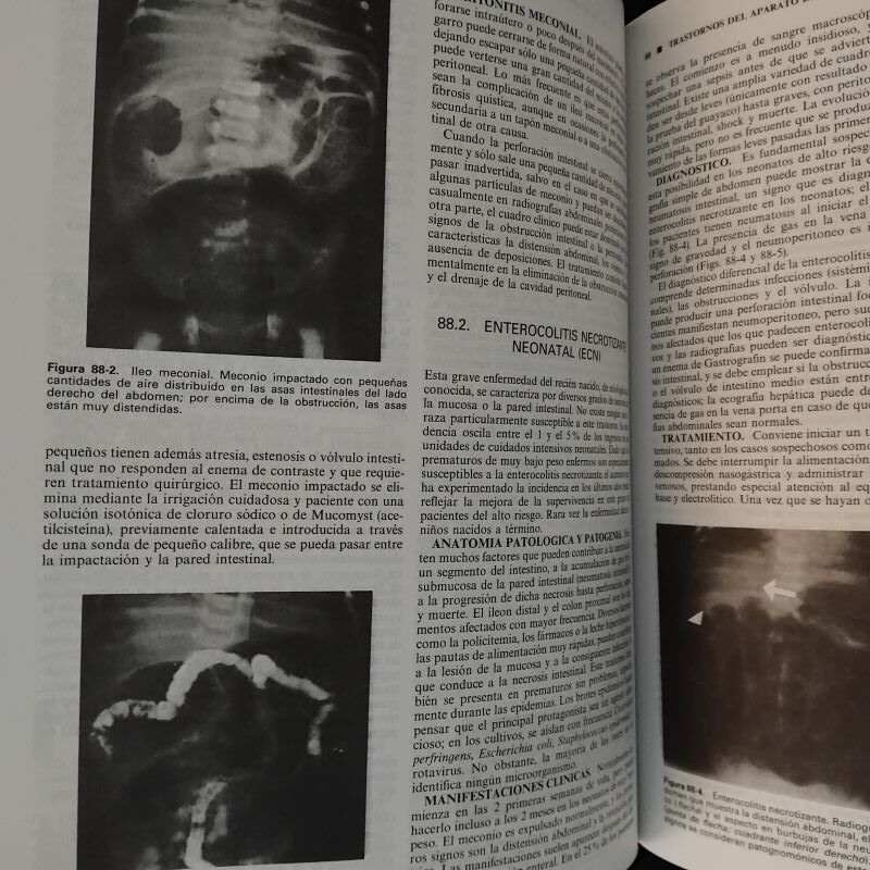 Nelson Tratado de Pediatría, volúmenes I y II, de Richard E. Behrman, Robert M. Kliegman y Ann M. Arvin - Imagen 3